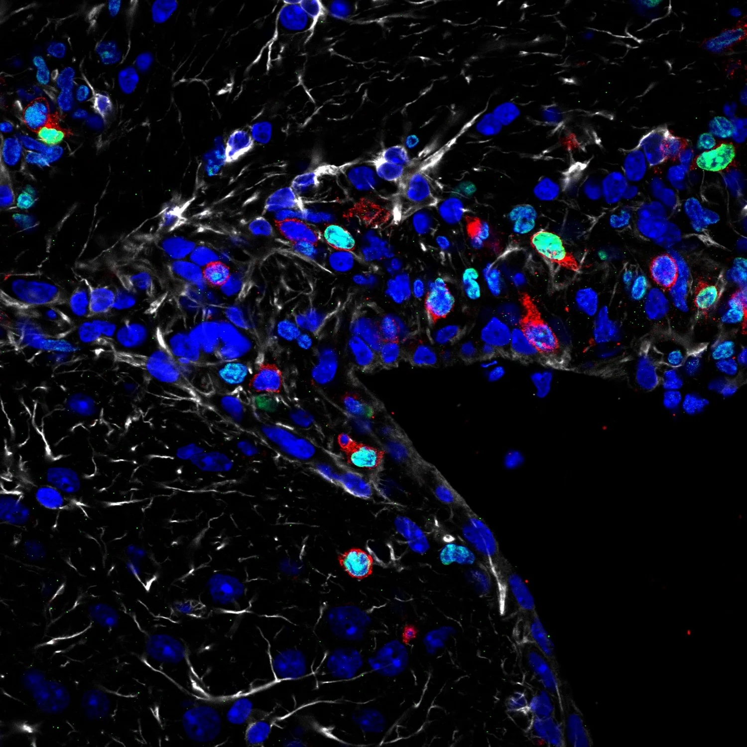 Blue, green, and red blobs on a black background.