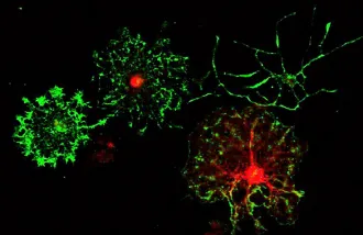 Oligodendrocyte precursor cells (OPCs) that the Gibson lab cultures in vitro and differentiates into myelinating oligodendrocytes. Image by Erin Gibson.