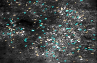 Fluorescence image of hippocampus with distinct groups of cells highlighted in orange and blue