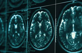 A set of three brain scan images.