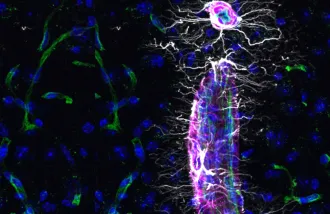 young perivascular flow