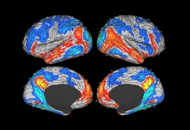 Brain scan images with some regions highlighted in reds and blues.