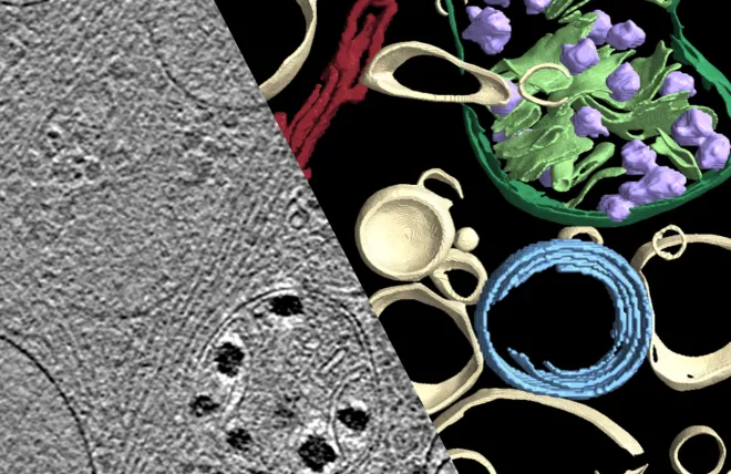 Cryogenic electron tomography (cryoET) image (left) and AI-based segmentation (right) of subcellular features in a human fibroblast, used to investigate the molecular architecture underlying neurodegenerative diseases.