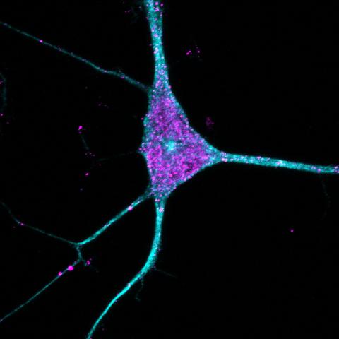 A neuron outlined in blue with purple dots indicating amyloid beta 42.