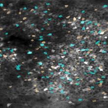 Fluorescence image of hippocampus with distinct groups of cells highlighted in orange and blue